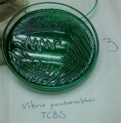 vibrio on tcbs agar